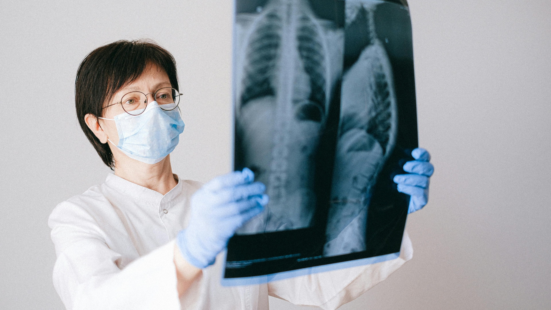  Sering Disalahartikan, Apa Bedanya TBC dan Kanker Paru? 